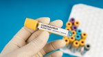 Coronavirus outbreak: The rules to follow if you have to self isolate