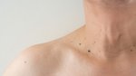 Understanding Skin Tags: Causes, Risks, Safe Removal Methods and What They Cost